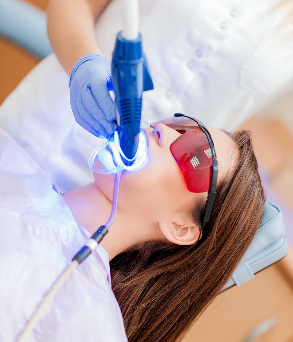 Teeth whitening on Yonge and Eglinton