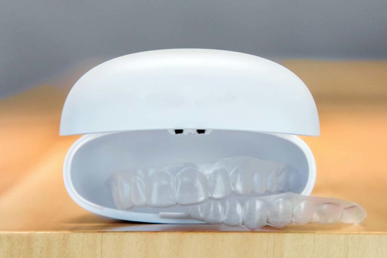 big advantages of invisalign