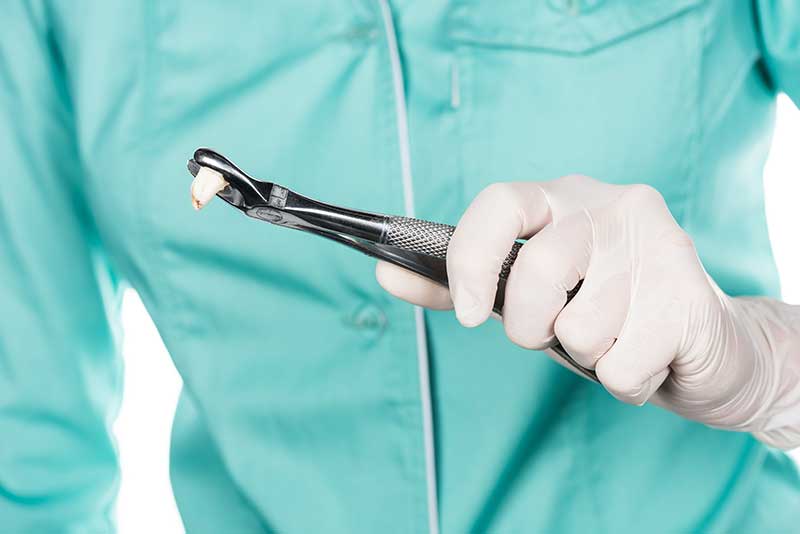 Emergency Teeth Extraction in Yonge and Eglinton