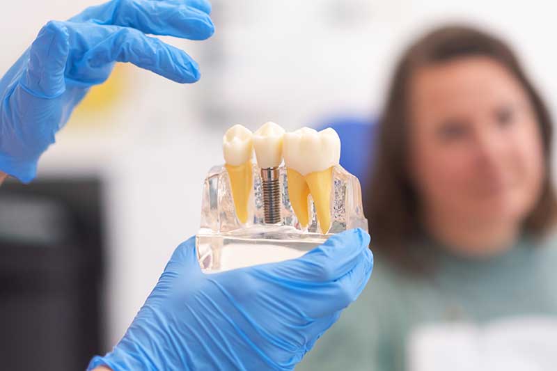 Dental Implants at 6ix Eglinton Dental